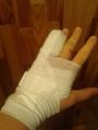 Image attachée: 20150517_065655 Fracture.jpg